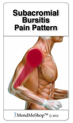 Subacromial Bursitis, Shoulder Bursitis, Deltoid Muscle, Bursitis Shoulder