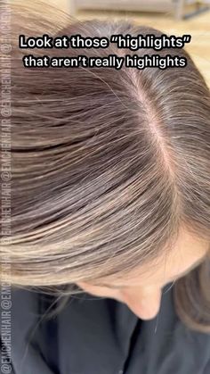 Grey Hair Diy, Demi Hair Color, Goldwell Colorance, Hair Jazz, Premature Grey Hair, Grey Hair Transformation, Hair Issues