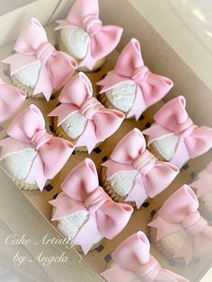 Cupcake Coquette, Coquette Decoration, Ballet Birthday Cakes, Easy Room Makeover, Cakes Cute, 35 Birthday, Bow Cupcakes, Birthday Room, Girly Birthday Party