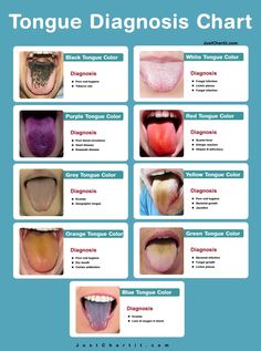 Tongue Color Meaning, Tongue Anatomy, Chinese Tounge Health, Tongue Infection, Tongue Health Chart, Tongue Cleaning, Tongue Chinese Medicine, Tongue Problems, Structure Of Tongue