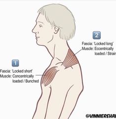 Body Muscle Anatomy, Punkty Spustowe, Body Massage Techniques, Physical Therapy Exercises, Spine Health, Muscle Anatomy, Human Anatomy And Physiology, Neck And Shoulder Pain