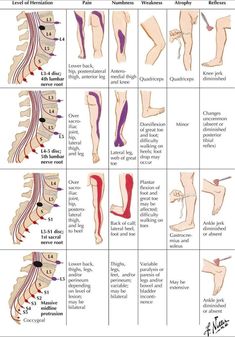 upper back nerve pain relief Straight Leg Raise, Spinal Nerve, Nerve Pain Relief, Sciatic Nerve Pain, Sciatic Nerve, Diy Remedies, Natural Pain Relief, Massage Techniques