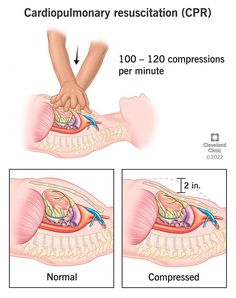 How To Do Cpr, How To Perform Cpr, Welcome To Florida, Cardiopulmonary Resuscitation, Baby Shark Song, Cpr Training, Normal Heart, Medical Student Study, Health Psychology