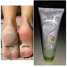 Oriflame feet up Advanced cracked heel repair and soothing cream! Intensive cream with urea,cocoa butter, panthenol and minerals 4E blend! To Help restore and protect the condition of rough cracked skin. Visible improvement in just 3 days. Clinically amd consumer tested! In stock now! Grab it now! For discount & Order inbox us Rs 929 #OriflamePakistan #oriflame Dry Feet Remedies, Eye Make Up Videos, Heel Repair, Cracked Heel, Tips For Oily Skin, Cracked Heels, Allah Photo, Cracked Skin