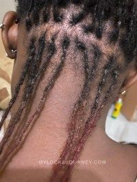 How To Remove Lint, Dread Shampoo, Best Clarifying Shampoo, Loc Updo, Haircare Tips, Women Braids, Hair Cleanser, Beauty And Health