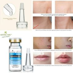 ARTISCARE Coenzyme Q10 Aging Hydraterende Olie-control Whitening Serum10ml Description relieves redness and shrinks pores 10ml Anti-aging,Anti-Wrinkle,Firming,Moisturises,Hydrates Also helps:Acne,Dark Circles,Wrinkles,Puffiness,Clearing impurities,Skin problems,Moisturising 2-3 drops will be ok,donnot use it too much.If you on mask,you can use more than 3 drops. Pat , until the liquid is completely absorbed by the skin When you donnot use it,just keep the small cover on the dripper.Please noted Serum For Dry Skin, Erase Wrinkles, Face Brightening, Wrinkle Serum, Coenzyme Q10, Receding Gums, Skin Redness, Anti Aging Facial, Anti Aging Face