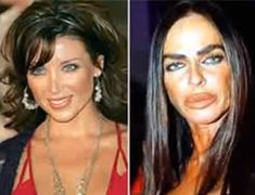 Reconstructive Surgery, Priscilla Presley