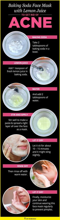 Face Masks For Acne, Masks For Acne, Baking Soda For Acne, Obličejové Masky, Baking Soda Face Mask, Baking Soda Face, Homemade Facial Mask, Skin Face Mask, Acne Face Mask