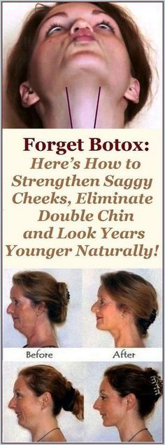 Board name Saggy Cheeks, Být Fit, Double Chin Exercises, Facial Yoga, Face Exercises, Saggy Skin, Health And Exercise