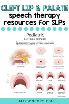 Frontal Lisp Activities Speech Therapy, Cleft Palate Speech Therapy, Slp Praxis, Speech Language Pathology Grad School, Praxis Study, Speech Disorders, Speech Therapy Ideas, Oral Motor Activities, Myofunctional Therapy