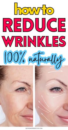 Want smooth, youthful skin? These 11 wrinkle remedies face tips are exactly what you need! Discover the best natural wrinkles remedies to help prevent wrinkles and keep your skin firm. From oils to self-massage, these anti aging tips will have you glowing. Check out the blog for more diy wrinkles remedies and keep those face wrinkles in check! Wrinkle Remedies Face, 11 Wrinkles, Natural Wrinkle Reducer, Natural Wrinkle Remedies, Wrinkles Remedies, Wrinkles Remedies Face, Dark Spots Remedies, Diy Wrinkles, Natural Beauty Secrets