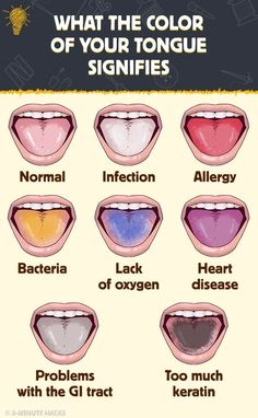 #foryou#trend#women#men#pinterest#health#cancer Human Tongue, Gi Tract, Shocking Facts, Health Knowledge, Reflexology, Health Facts, Warning Signs, Health Remedies