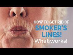 How to remove smoker's lines- update - YouTube Lines Around Mouth, Smokers Lines, Mouth Wrinkles, Upper Lip Hair, Makeup For Moms, Lip Wrinkles, Eye Wrinkle, Lip Hair, Oral Health Care