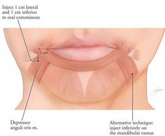 Botox For Headaches, Botox Injection, Homemade Face Mask