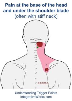 upper back nerve pain relief