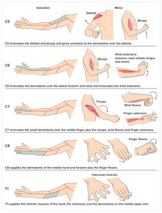 Punkty Spustowe, Pinched Nerve, Physical Therapy Exercises, Muscle Anatomy, Human Anatomy And Physiology