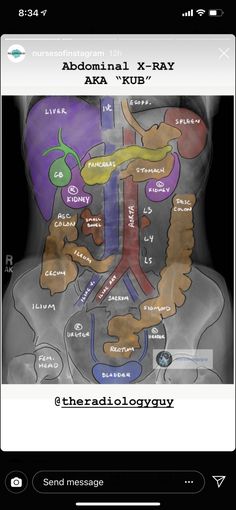 an app showing the location of the abdomen and its major organs, including the stomach