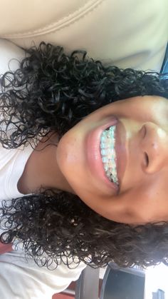 Ceramic Braces With Colored Bands, Ceramic Braces Color Bands, Turquoise Braces, Braces Journey, Ski Trip Essentials, Shiny Teeth, Ceramic Braces