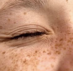 an image of a woman with freckles on her face