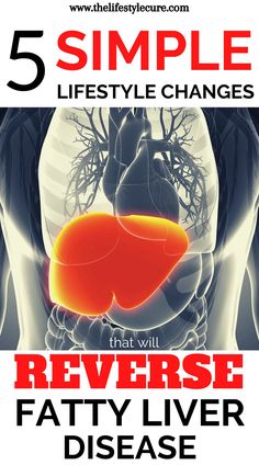 Want to reverse fatty liver disease? Well it's possible! As a medical doctor, chronic diseases make up the majority of cases that doctors see on a regular basis. But what most don't know is that these diseases are lifestyle related, meaning you can change the outcome! Read to know the 5 proven lifestyle changes that will reverse fatty liver disease and other chronic diseases. #reversefattyliverdisease #fattyliverdisease #fattyliver #howtogetridoffattyliver #fattyliverdiet Lung Detox, Kidney Detox, Simple Lifestyle, Medical Doctor, Simpler Lifestyle