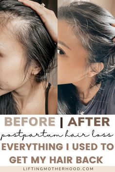 Hair Fall Solution, Hair Growing Tips, New Hair Growth, Hair Control