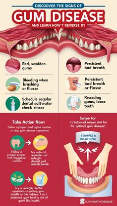 "Discover the top foods that promote gum health. Learn how a balanced diet can help you achieve healthier, stronger gums naturally." Tags: #HealthyGums #GumHealth #Nutrition #OralCare #HealthyEating Grow Back Receding Gums, Tooth Health, Dental Cabinet, Dental Tips, Swollen Gum, Medical Animation, Gum Recession