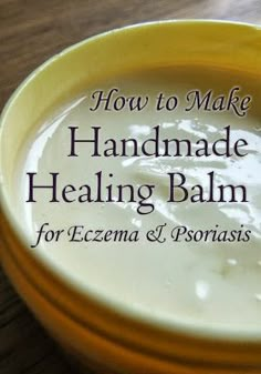 Skincare recipe for making a healing balm for Eczema & Psoriasis - all natural! #beauty Shampoo Diy, Healing Balm, Natural Healing Remedies, Diy Remedies, Natural Therapy, Homemade Remedies, Homemade Beauty, Skin Care Recipes