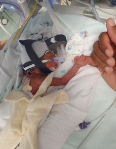 a baby in a hospital bed with an oxygen tube