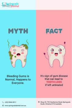 Myth vs. Fact: Bleeding Gums Edition! Myth: Bleeding gums during brushing or flossing is normal and happens to everyone. Fact: Healthy gums shouldn't bleed! Bleeding gums could signal gum disease or other dental issues. Please don't ignore it; consult your dentist. #oralhealth #DentalMythsBusted #DentalCare #BleedingGums #oralhygienetips #EmergencyDentalCare #EmergencyDentists #dentistinspringvale #saycheese #dentistnearme #oralcare Myth Vs Fact, Dental Jokes, Swollen Gum, Healthy Gums, Dental Emergency, Hygiene Tips, Dental Marketing, Dental Humor