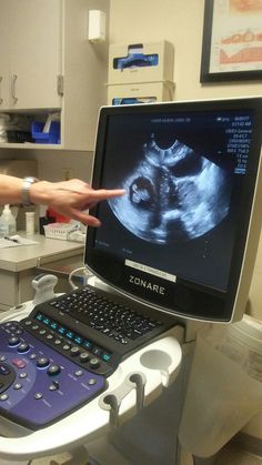 a person points at an x - ray image on a computer screen in a medical room