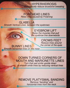 Botox Brow Lift, Diagram Ideas