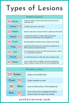 an info sheet describing different types of skin