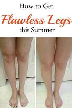 Smooth Legs, Baby Soft Skin, Astuces Diy, Son Quotes, Beauty Remedies, Skin Remedies, Viscose Rayon, Soft Skin, Health And Beauty Tips