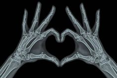 two hands in the shape of a heart with their fingers extended up to form an x - ray