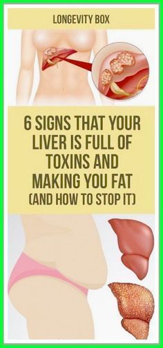 This is a warning sign for a damaged liver. Do not ignore! Autogenic Training, Smart Ideas, Body Detox, Motivation Fitness