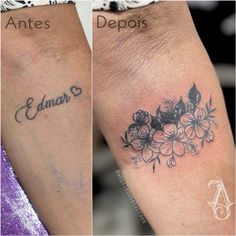 before and after tattoo removals on the legs, with flowers in blooming over them