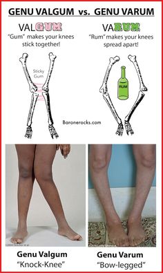 the legs and ankles are labeled with different types of veining on each one side