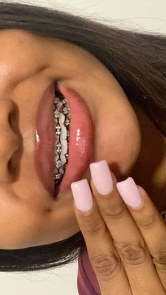 Braces Vision Board, Straight Teeth With Braces, Colors To Get On Braces, Braces Manifestation, Powerchain Braces Aesthetic, Braces On Crooked Teeth, Black Power Chain Braces, Dark Red Braces, White Teeth With Braces