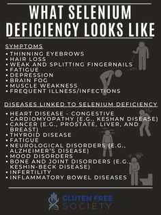 Does Gluten Cause Selenium Deficiency - Gluten-Free Society Selenium Deficiency Symptoms, Selenium Deficiency, Deficiency Symptoms, Thyroid Healing, Sick Remedies, Hashimotos Disease, Thyroid Health, Adrenal Fatigue, Health Guide