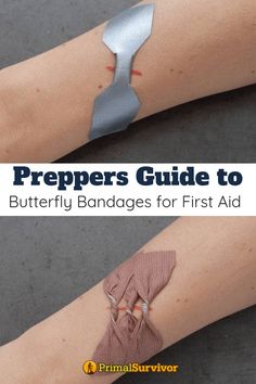 a person with bandages on their arm and the words preppers guide to butterfly bandages for first aid