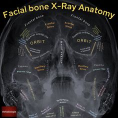 an x - ray image with the words facial bone x - ray anatomy on it