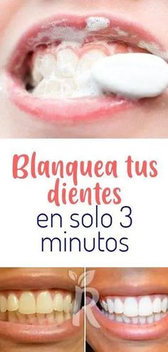 Cuidar de nuestra salud bucal es esencial para mantener una sonrisa radiante y prevenir enfermedades de las encías. Si buscas una alternativa natural a las pastas dentales comerciales cargadas de productos químicos, has llegado al lugar adecuado..
#dentalhealth, #dentalhealthcare Natural Cough Remedies, Cough Remedies, Tooth Decay, Natural Home Remedies, Oral Hygiene