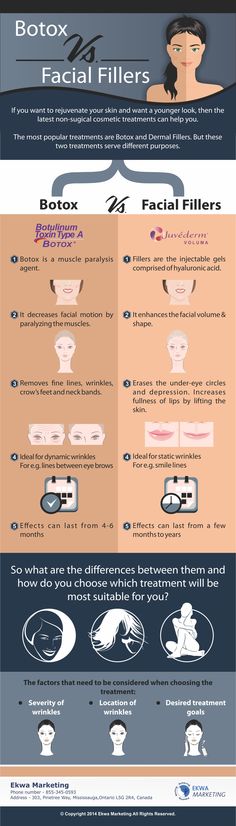 #skincare #skin #dermalfillers Botulinum Toxin, Fine Wrinkles, Muscle Relaxer, Face Skin, Skin Treatments, Helpful Tips