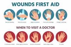 Safety Infographic, Nursing School Studying, Wound Dressing, Take Care Of Your Body, Medical Help, Diy Health, Natural Health Remedies