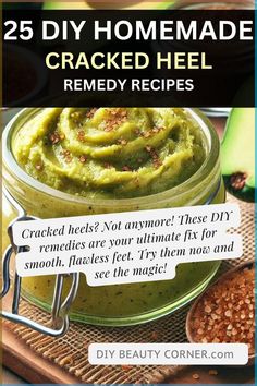 Say goodbye to dry, cracked heels with these 25 DIY homemade remedies. From foot soaks to heel treatments, these recipes help soften and repair damaged skin using natural ingredients. Whether you're dealing with heel fissures, cracked feet, or dry heels, these DIY remedies provide instant relief and long-term repair. Treat your feet to the care they deserve and heal cracked heels today! #CrackedHeelRemedies #FootSoak #DryHeels #HeelRepair Cracked Heel Remedy, Dry Skin Home Remedies, Heel Fissures, Cracked Heel Remedies, Heal Cracked Heels, Diy Foot Soak, Foot Soaks, Soothing Face Mask, Dry Cracked Heels