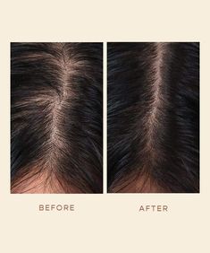 Serum For Hair, Hair Growth Women, Hair Growth Serum, Fuller Hair, How To Apply Mascara, Growth Serum, Thinning Hair, Hair Restoration, Roots Hair