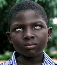 a young boy with blue eyes stares into the camera while wearing a checkered shirt