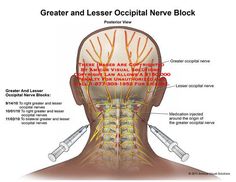 Occipital Nerve Block, Nerve Anatomy, Forward Head Posture Exercises, Medical Intuitive, Chronic Migraines, Migraine Headaches, The Skull