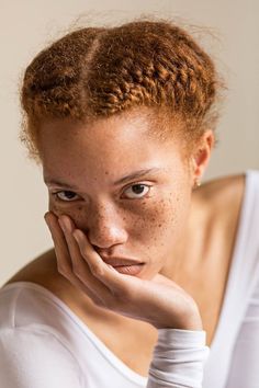 a woman with freckles on her face and hand near her chin looking at the camera