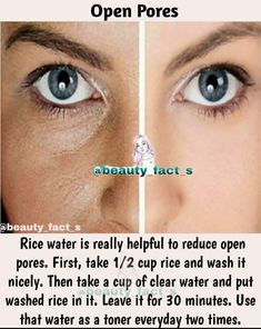 Clear Skin Face, Skin Face Mask, Open Pores, Clear Healthy Skin, Natural Skin Care Remedies, Natural Face Skin Care, Good Skin Tips, Rice Water, Beauty Tips For Glowing Skin